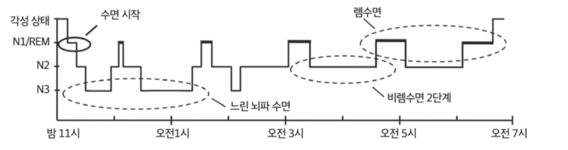 Sleep State Detection MDSA YeonsookKwak 6