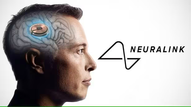 Neuralink TE 001 20240805